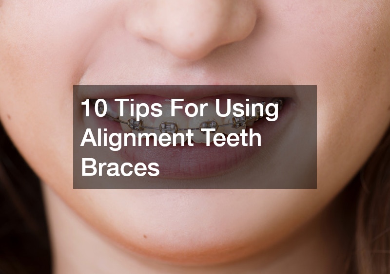 10 Tips For Using Alignment Teeth Braces